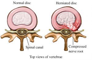 Top Views of Vertebrae