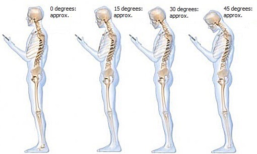 Bad Posture: How It Hurts and How You Can Fix It