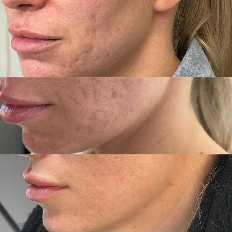 Results | BC Cosmetics