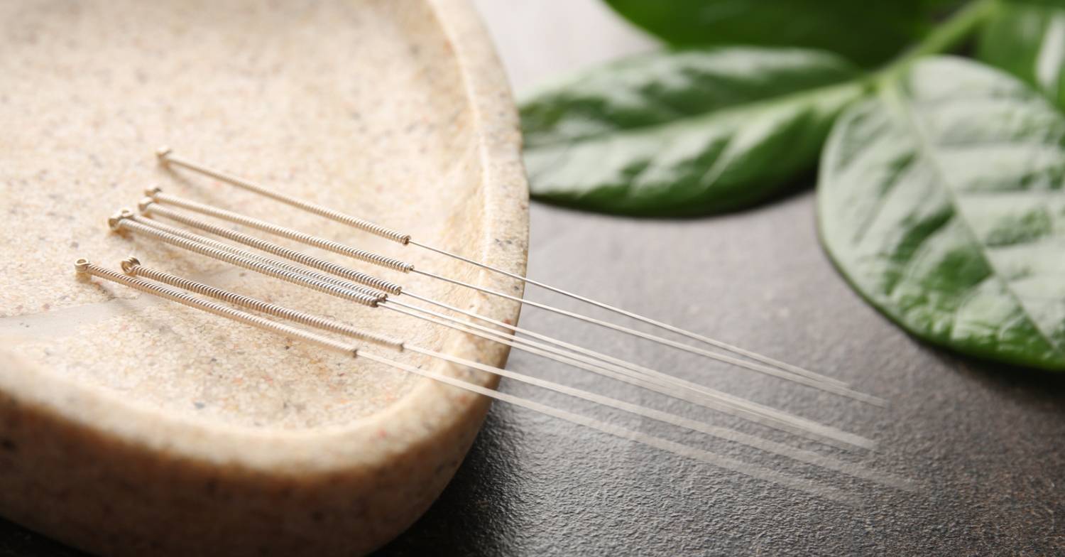 How Acupuncture Works 