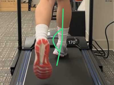 Gait Analysis on Treadmill