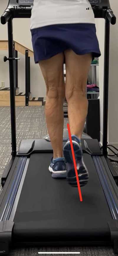 Gait Analysis