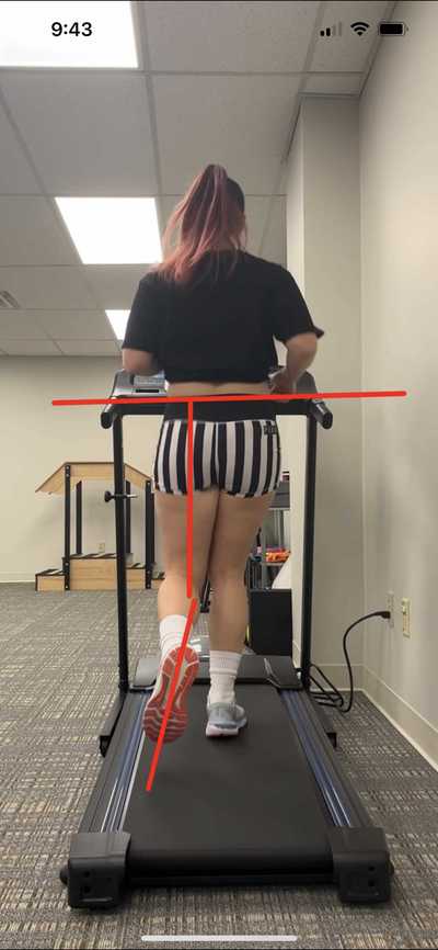 Gait Analysis