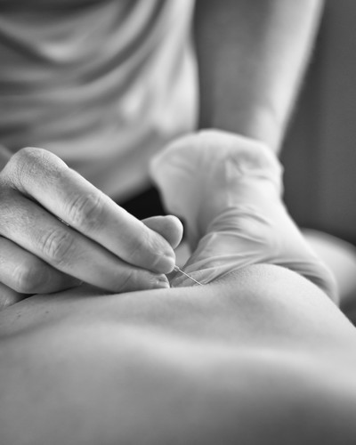 Link to: /pages/dry-needling