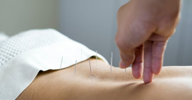 Cupping, Tui Na, Gua sha