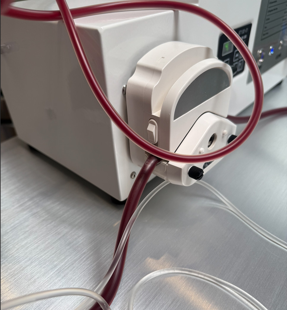 EBOO blood before and after