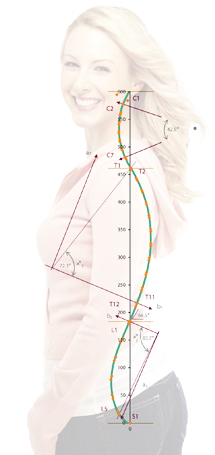 woman-with-curved-spine