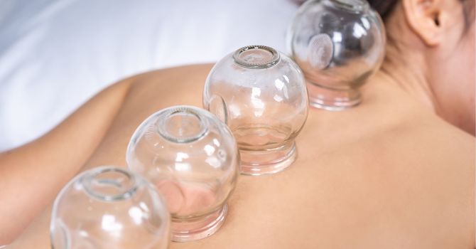 Acupuncture for Weight Loss