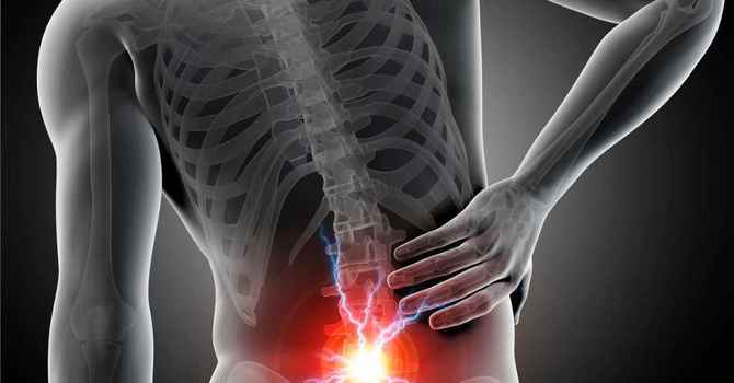 Lower Back Pain image