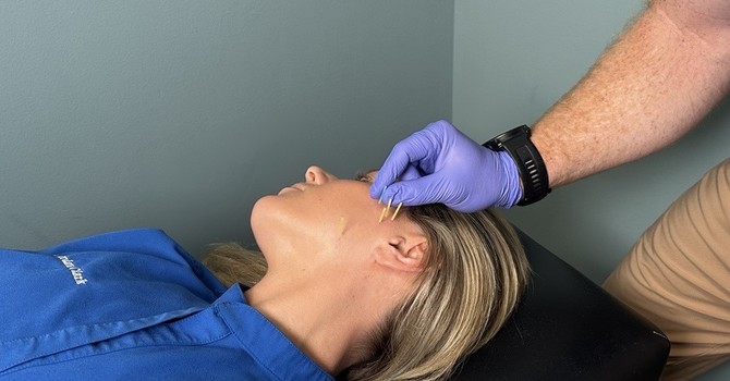 Dry Needling