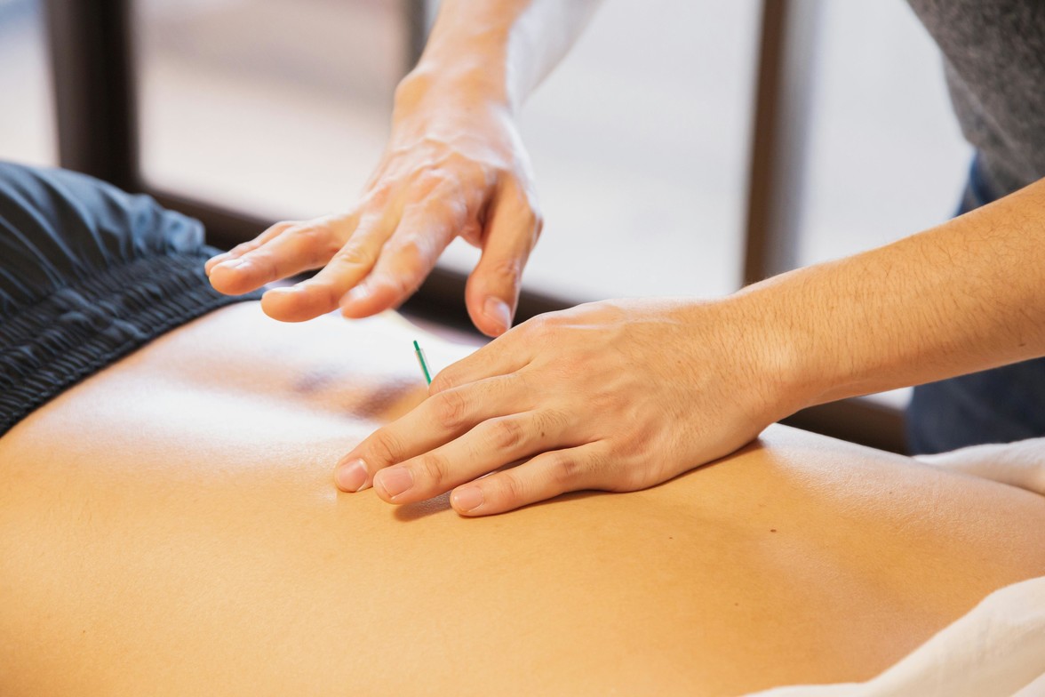 A person receiving a personalized acupuncture treatment.