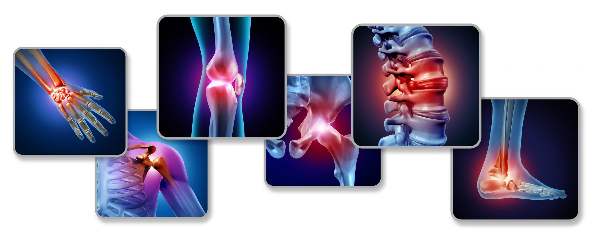 bigstock-Pain-Of-The-Joints-Concept-As-320085268-2048x842