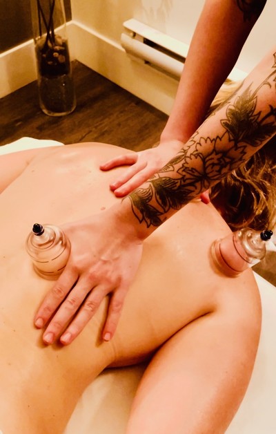 Link to: /pages/myofascial-cupping