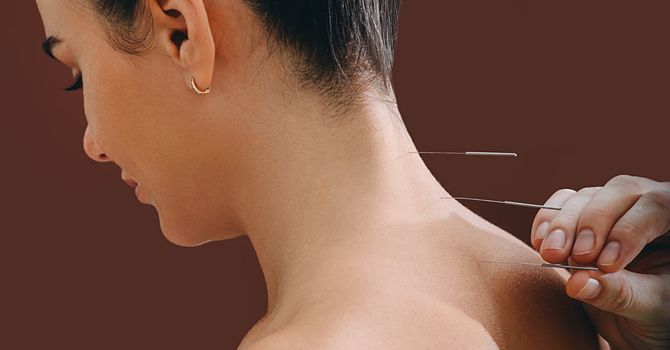 What Is Traditional Chinese Medicine (TCM) image