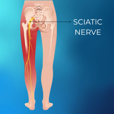 Pain Relief Without Surgery