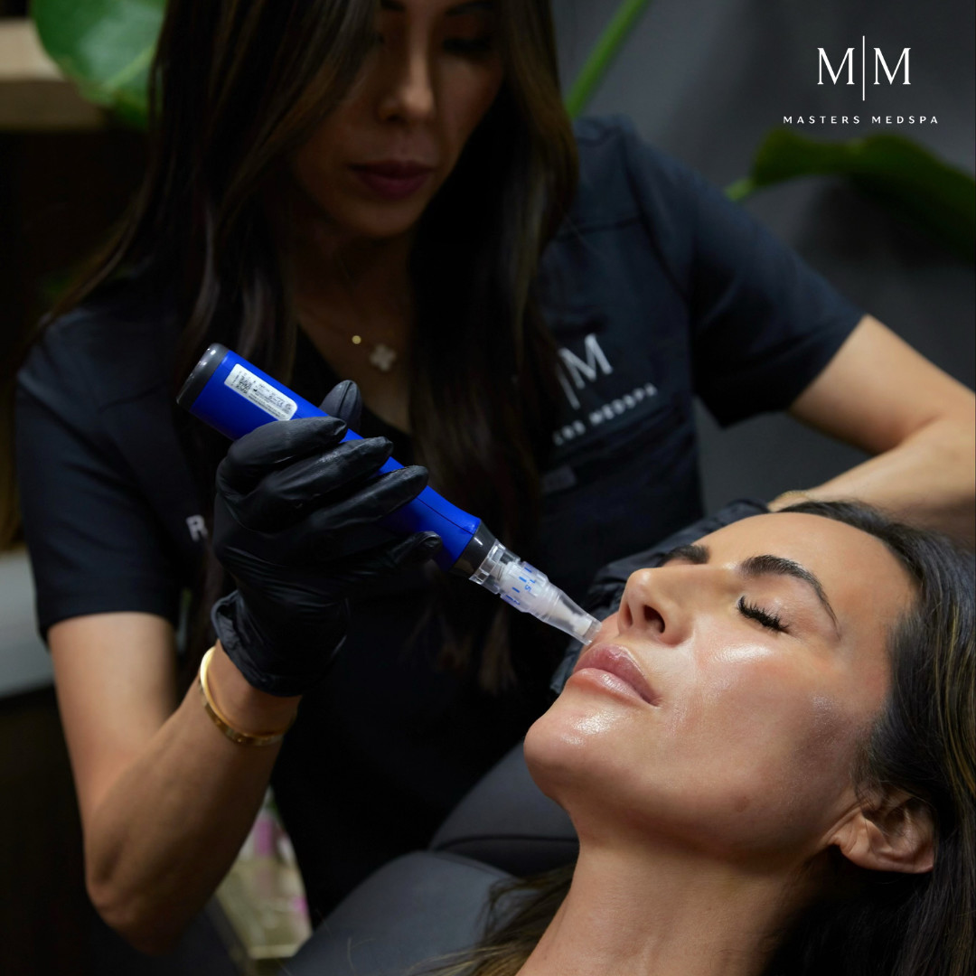 MM_MicroNeedling_Cheryl_1b