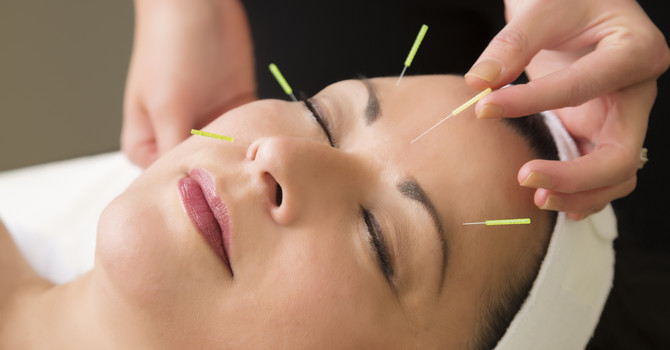 Facial Acupuncture