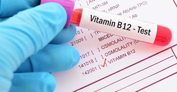 Vitamin B-12