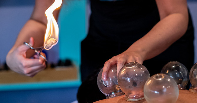 Cupping