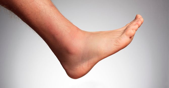 Expert Markham Foot Care: Keeping Your Feet Healthy and Pain-Free image