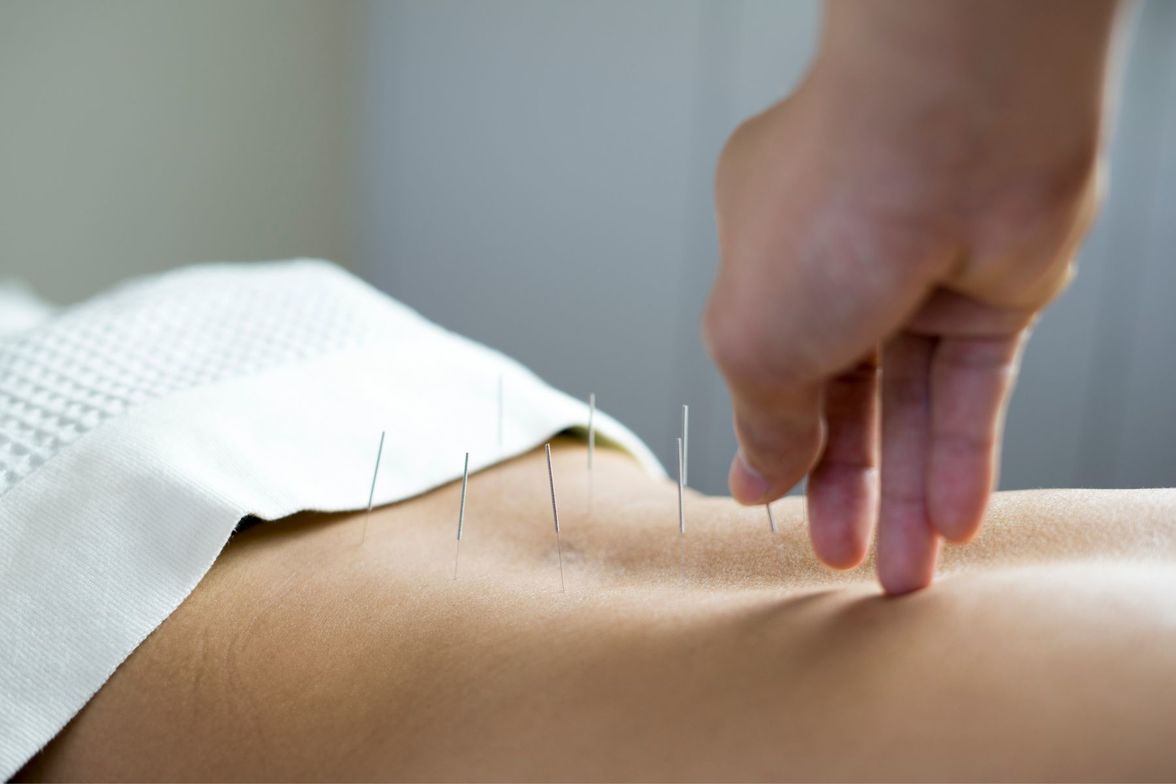 Acupuncture and Women's Health