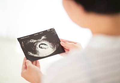 expectant parent looking at sonogram photo