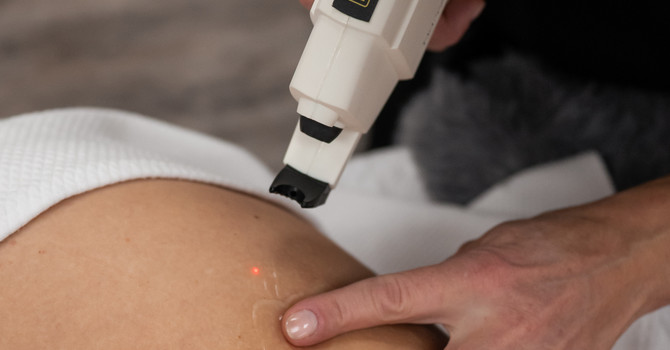 Nd: YAG Laser Treatments