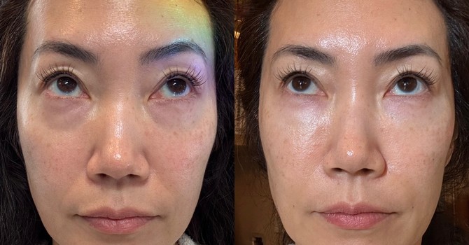 EZ gel Under Eye Treatment