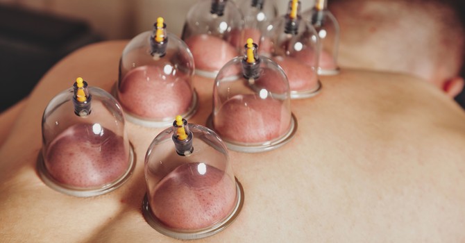 Cupping Massage
