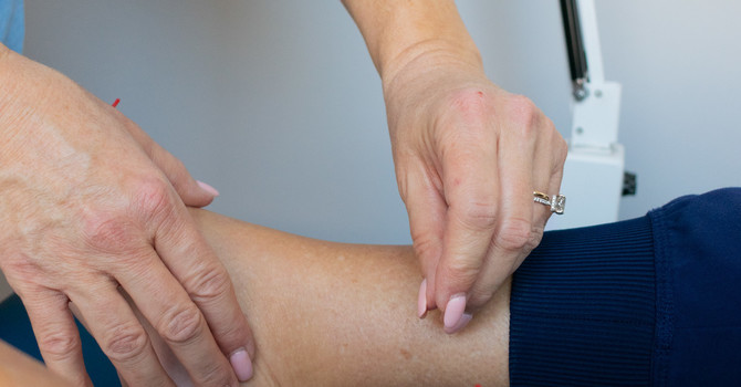 Acupuncture for Colds & Flu image