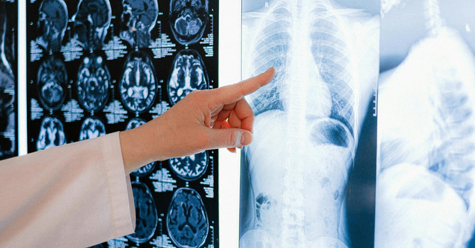 Why Your MRI Might Be Lying: The Hidden Drivers of Chronic Pain