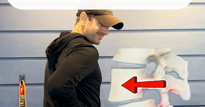 Spondylolisthesis Explained: Can a Vertebra Really Slip and Cause Back Pain?