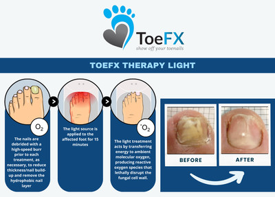 Link to: https://www.toefx.com/
