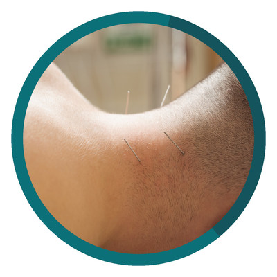 recovery-session-dry-needling-icon