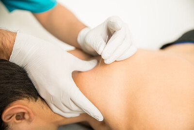 IMS/Dry Needling & Acupuncture