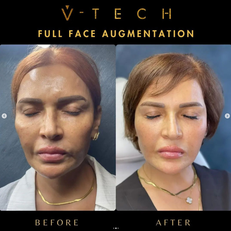 before and after photo