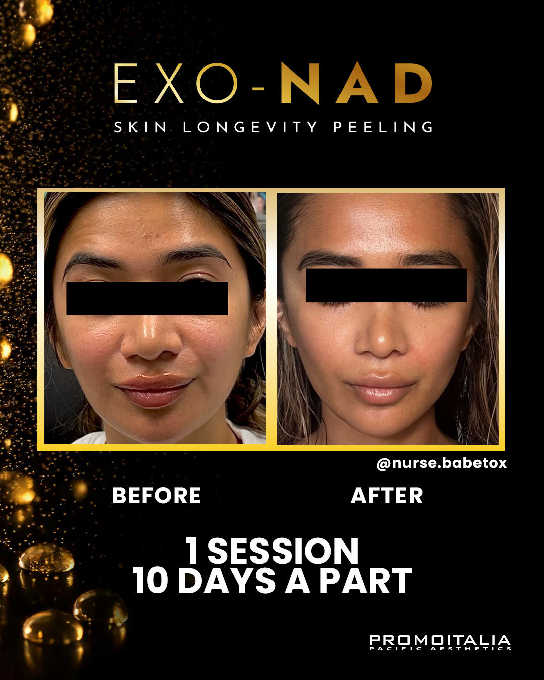 NT_Posting_June28_01