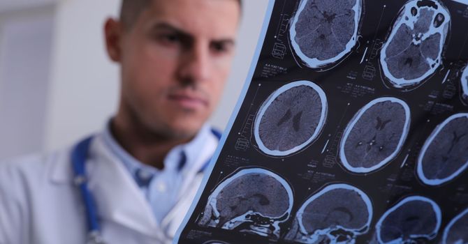 How Long Do Concussions Last? What to Expect and When to Seek Help