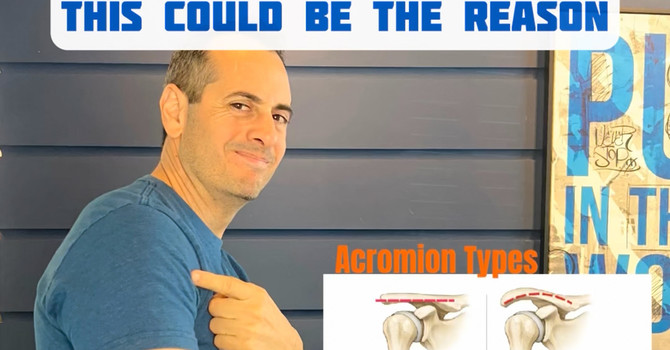 Trouble Lifting Your Arm Overhead? Your Acromion Shape May Be the Reason