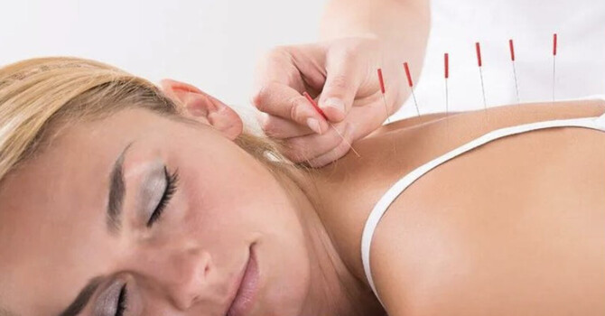 Medical Acupuncture
