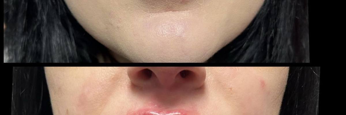 Aesthetic Unfiltered Aurora & Ocelli Aesthetics Terre Haute