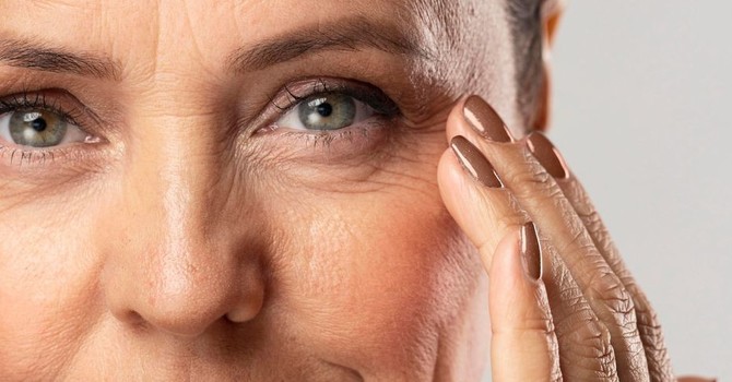 Loss of Facial Volume & Structure