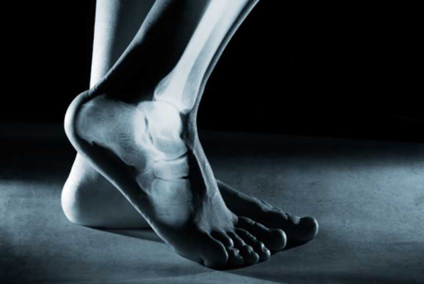 Custom Foot Orthotics