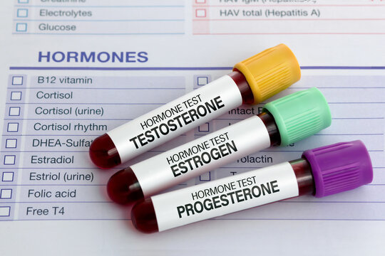 When is the Best Time to Test for Hormone Imbalance? 