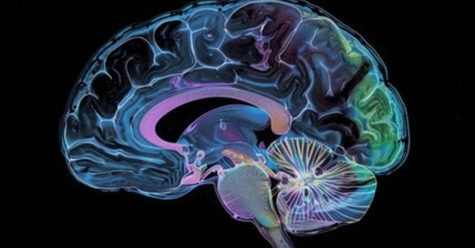 Understanding Deep Brain Reorienting: A Brief Overview for Clients image