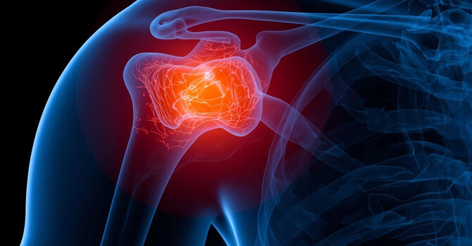 Frozen Shoulder / Rotator Cuff