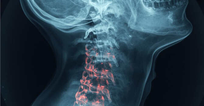 Neck Pain