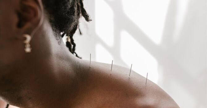 Acupuncture and Functional Medicine
