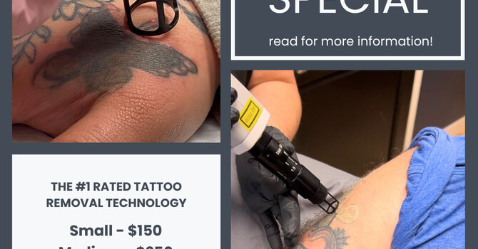 March Special: Pico Laser Tattoo Removal—Fast, Safe & Effective! image