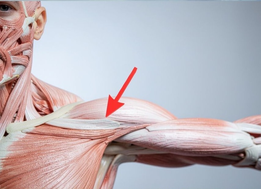 bicep_tendonitis_treatments_chiro_tampa_2026 (1)